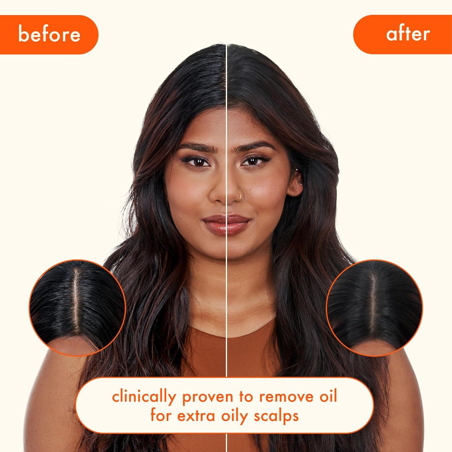 image:imageamika perk up ultra oil control dry shampoo cleans refreshes scalp roots absorbs helps control oils extends styles between washes for all hair types with extra oily scalps53 Ounce
